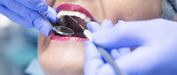 Best Emergency Wisdom Teeth Removal in Watsessing, NJ