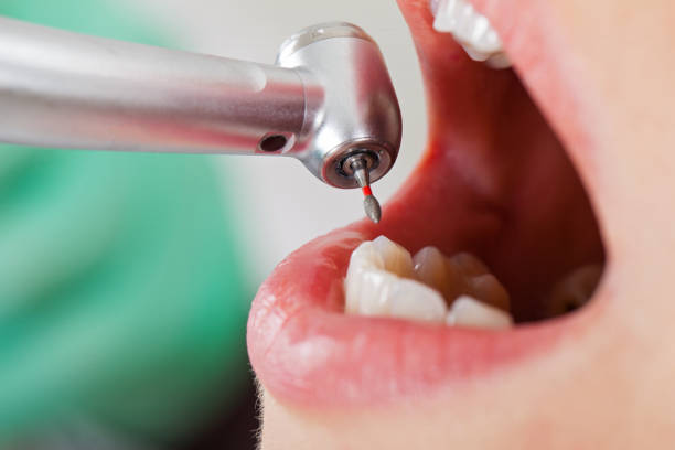 Best Emergency Treatment for Toothache in Watsessing, NJ